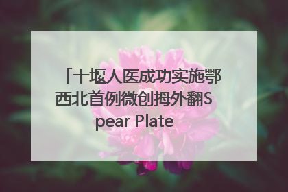 十堰人医成功实施鄂西北首例微创拇外翻Spear Plate髓内板矫形术